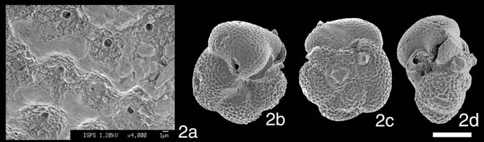 [Globorotalia rikuchuensis#2]